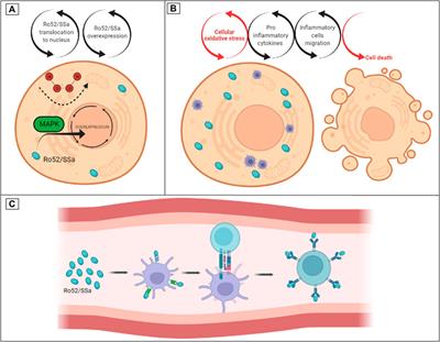 Oxidative Stress in the Protection and Injury of the Lacrimal Gland and the Ocular Surface: are There Perspectives for Therapeutics?